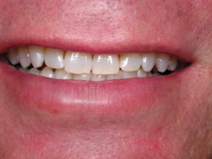 Dallas dentist Plano Richardson Addison cosmetic aesthetic Zoom