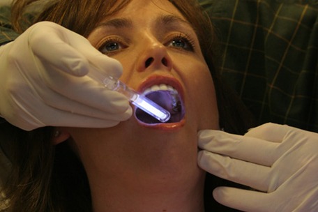 oral cancer screening, Venincasa Dental, Dallas dentist