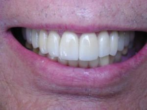 cosmetic dentist smile makeover