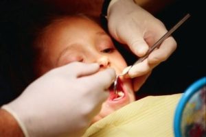quality dentist oral cancer prevention