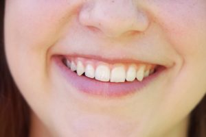 young woman with toothy smile and perfect white teeth