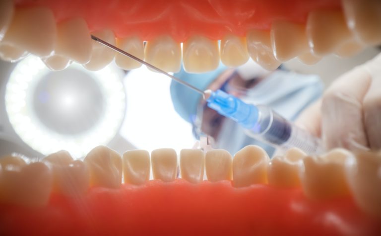 Patient at a dentist appointment in a dental clinic. View from inside the dental jaw.